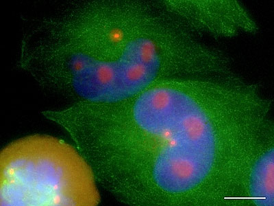 Nucleolar pericentrin in NZM9
